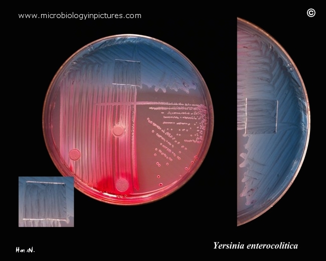 basic biochemical tests for identification of y.enterocolitica